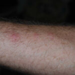 Gardening Splinter Risk